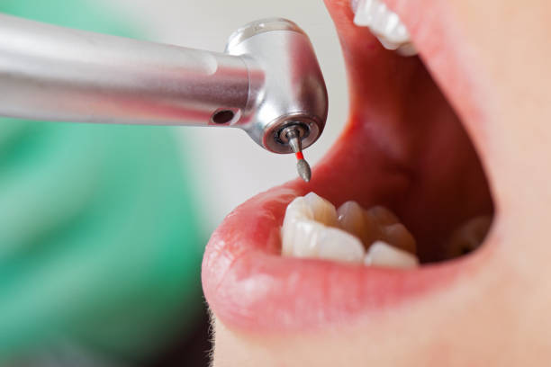 Best Emergency Treatment for Jaw Pain or Injury in Macungie, PA